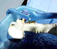 ���̍��̖l�́E�E�E�E�E������������́H