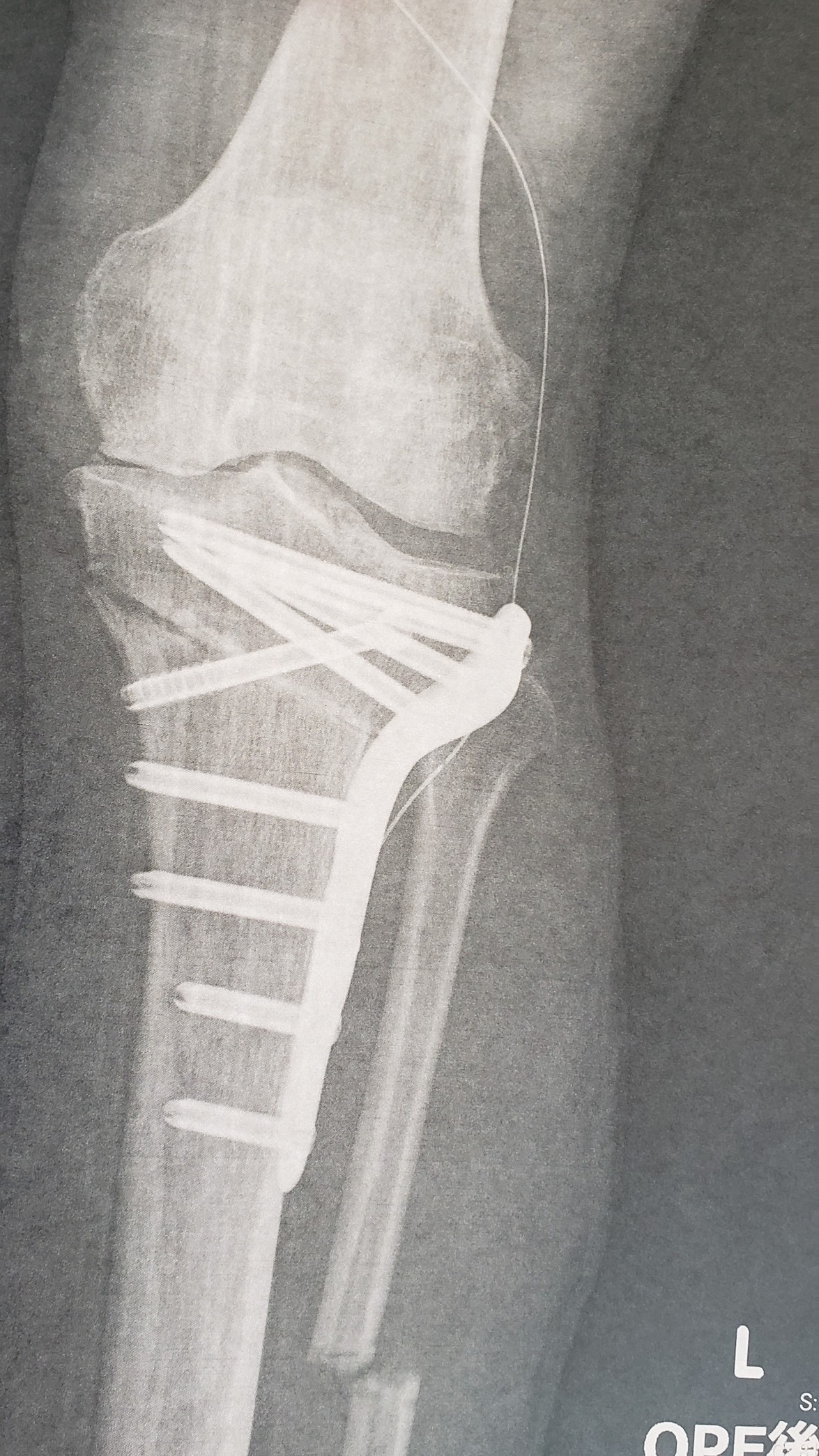 holy-knight�@     Senior Football