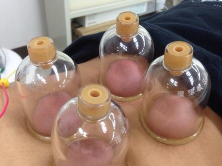 �����ߐ����@�@����  -��ʎ��́E�e��ی���舵��-