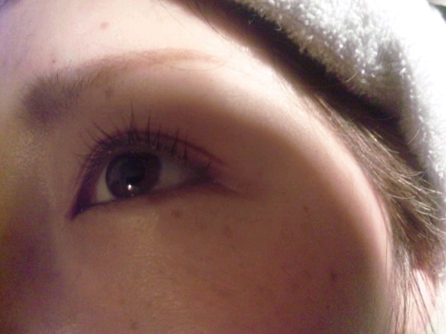 Misty Blog(�t�F�C�V�����G�X�e�T�����j