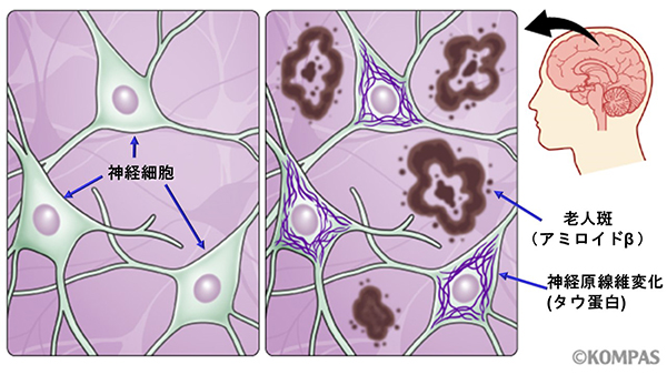 �A�}�`���A����ƁE�됶�̕s�o