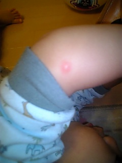 �V���[�x�b�g�̂�����